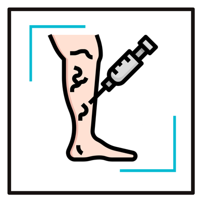 Varicose Vein Care